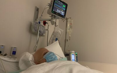 DIEP-Flap Reconstruction – 2 years later